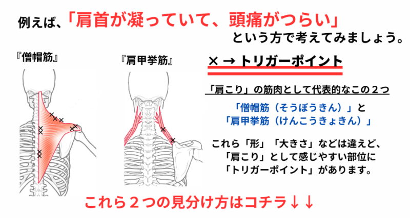 肩こりの症状に代表される僧帽筋と肩甲挙筋の解説