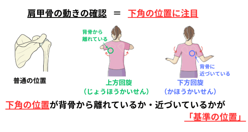 「肩甲骨の上方回旋と下方回旋の動きを示す図。肩関節の動きに伴う下角の移動を矢印で視覚化し、モビリティ評価や触診に役立つ教材。」