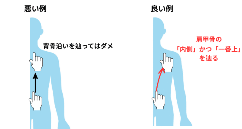 肩甲骨の上角を触診する際に、僧帽筋に誤って触れてしまうミスと、正しく上角を触れている例を比較した図。初心者セラピストのための触診精度向上に役立つ視覚教材