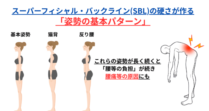 猫背、反り腰、前屈ができない姿勢など、代表的な不良姿勢を示すイラスト。筋膜のスーパーフィシャル・バックライン（SBL）に関連する姿勢パターンの視覚的説明。